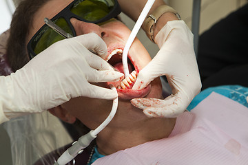 Image showing Visit to the dentist. Dentist at work in dental room