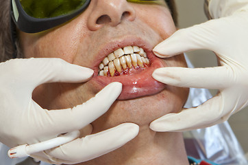 Image showing Visit to the dentist. Dentist at work in dental room