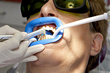 Image showing Visit to the dentist.