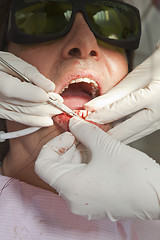 Image showing Visit to the dentist. Dentist at work in dental room