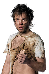 Image showing Burnt man