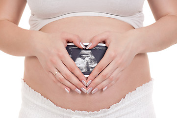 Image showing Pregnant with photo of her Ultrasound