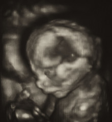 Image showing Ultrasonography Analysis of a 4th Month Fetus