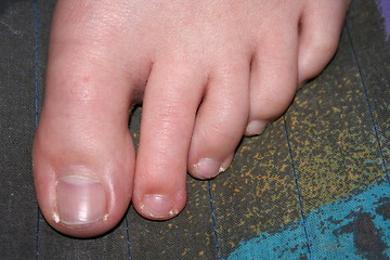 Image showing Toes