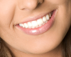 Image showing Healthy woman teeth and smile