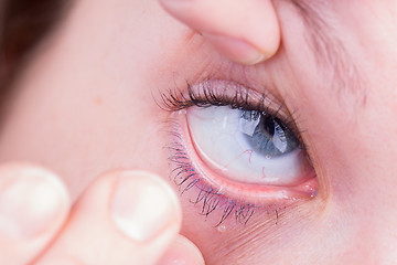 Image showing Close up of inserting a contact lens