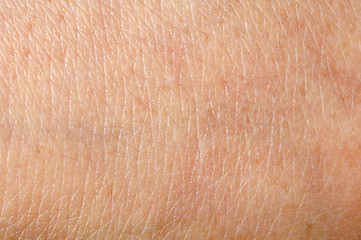 Image showing Human skin