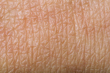 Image showing Human skin