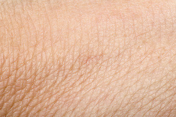 Image showing Human skin