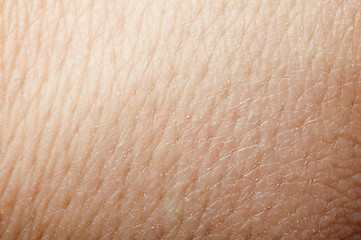 Image showing Human skin