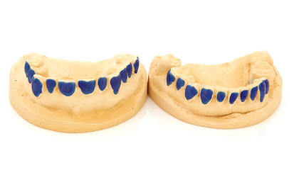 Image showing Dental Teeth Mould 