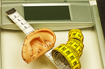 Image showing acupuncture for weight loss