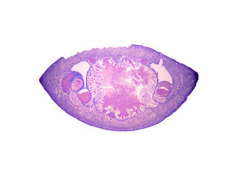 Image showing Photomicrograph of the medicinal leech (Hirudo medicinalis)