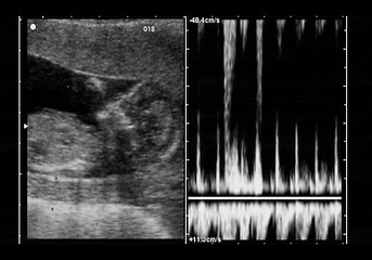 Image showing ultrasound fetus