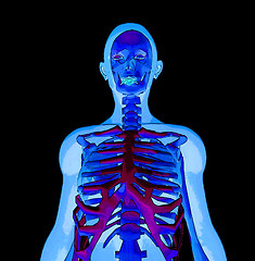 Image showing X Ray