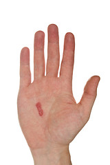 Image showing Callus on the male hand