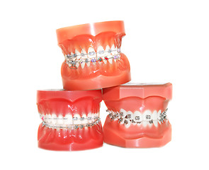 Image showing Teeth with braces isolated