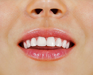 Image showing woman teeth