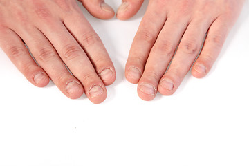 Image showing Finger nails