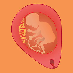 Image showing fetus