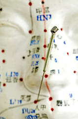 Image showing Acupuncture needle on head model