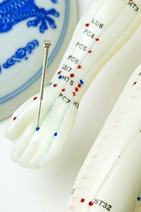 Image showing acupuncture demonstration on model 