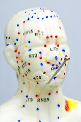 Image showing acupuncture demonstration on model 