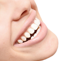 Image showing healthy smile