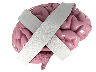 Image showing Dementia disease and a loss of brain function and memories as al