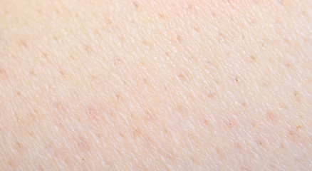 Image showing detailed skin