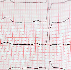 Image showing cardiogram