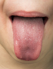 Image showing Human tongue protruding out