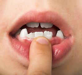 Image showing Child shows tooth