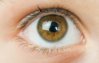 Image showing Human eye