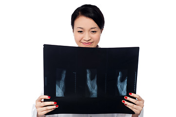 Image showing Female doctor analyzing patient's x-ray report