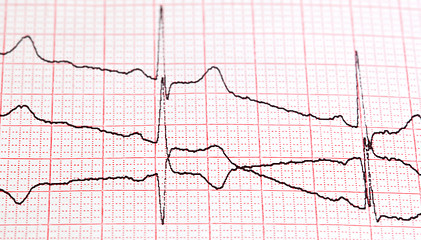 Image showing cardiogram