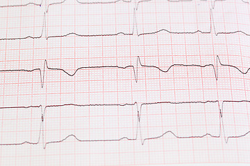 Image showing cardiogram