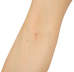 Image showing human arm