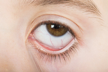 Image showing Human eye wide open