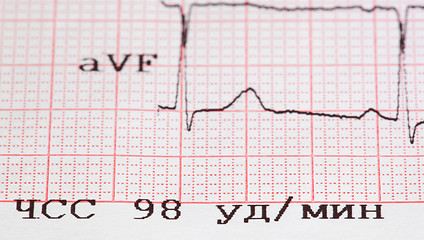 Image showing cardiogram