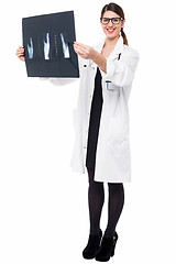 Image showing Female doctor reviewing patient's x-ray report