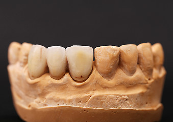 Image showing dental impression