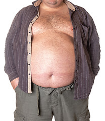Image showing Fat man with a big belly