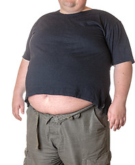 Image showing Fat man with a big belly