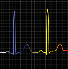 Image showing black ecg