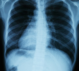 Image showing Chest xray scan