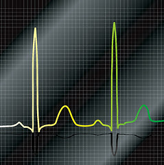 Image showing gradient ecg