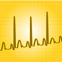 Image showing heartbeat yellow