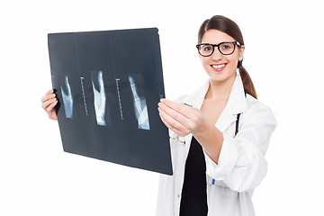 Image showing Female doctor holding up x-ray sheet