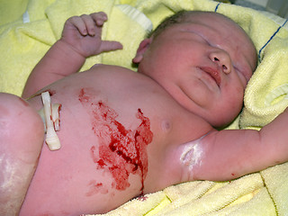 Image showing newborn child